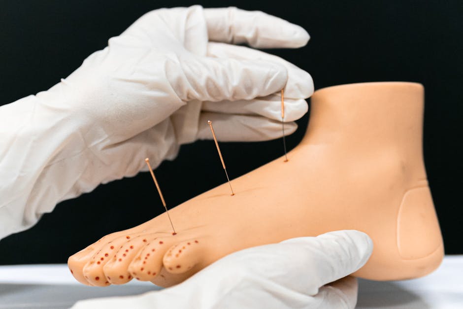 Acupuntura dói? Mitos e verdades sobre o tratamento