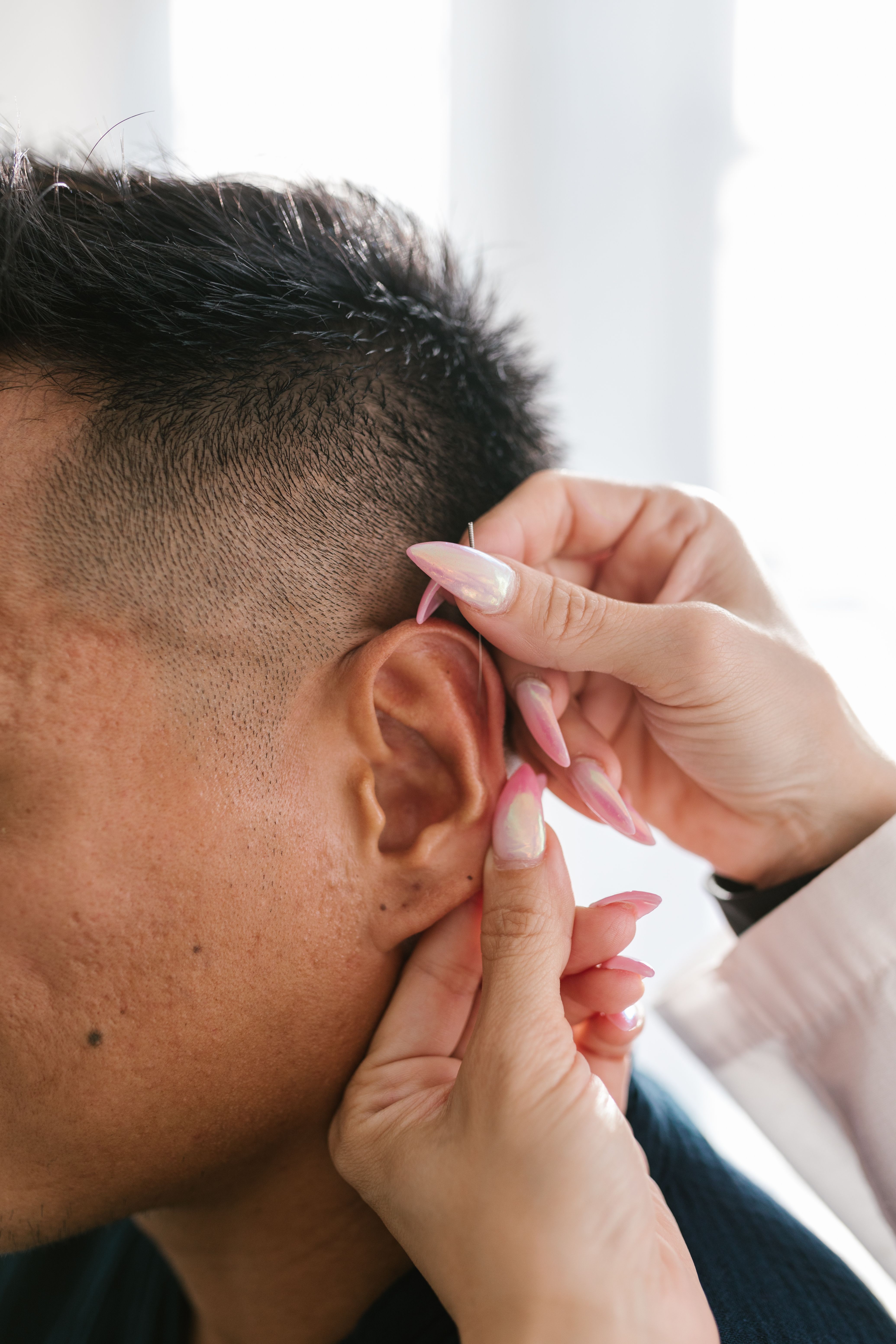 Auriculoterapia para emagrecimento: como os pontos da orelha ajudam
