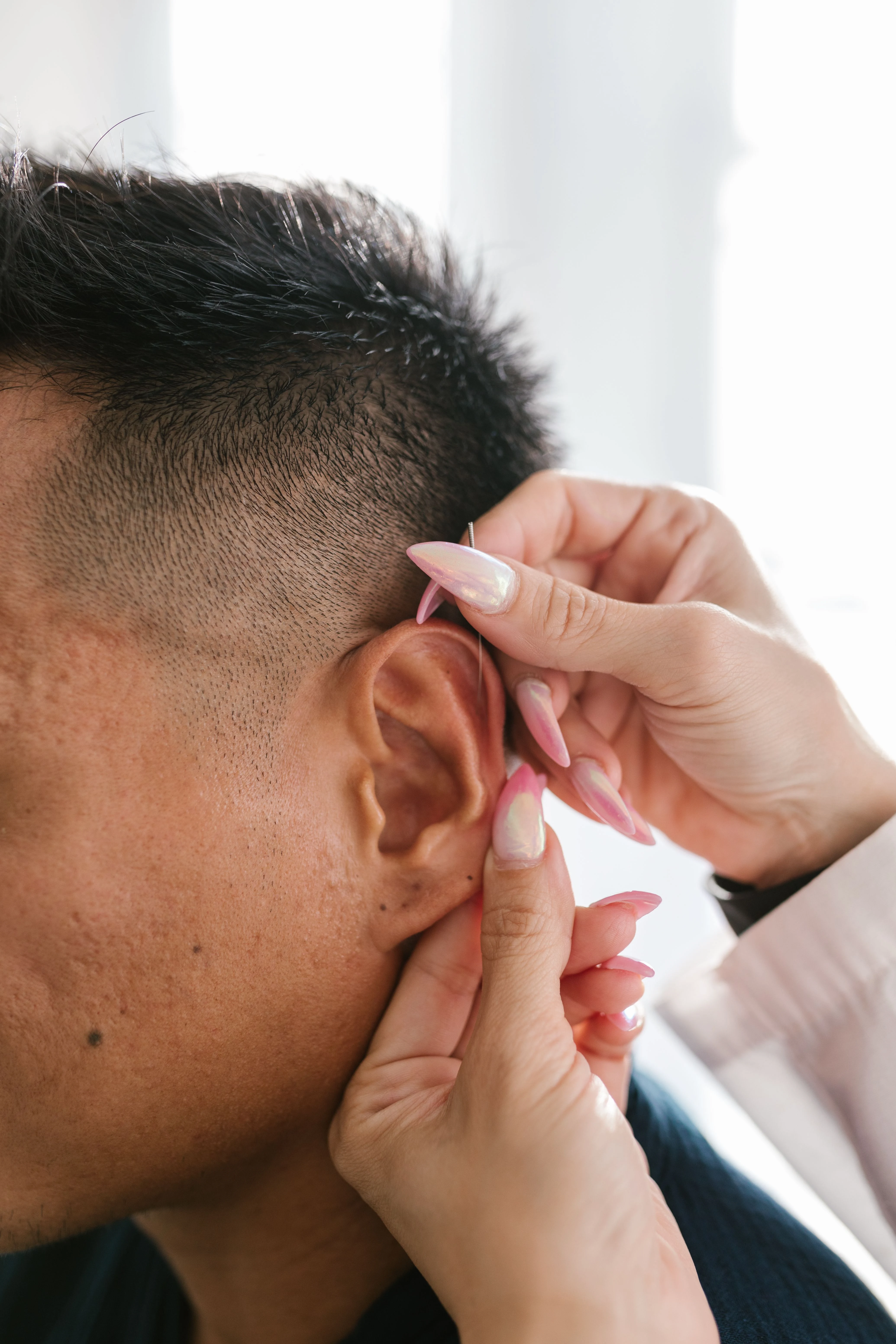 Auriculoterapia para emagrecimento: como os pontos da orelha ajudam