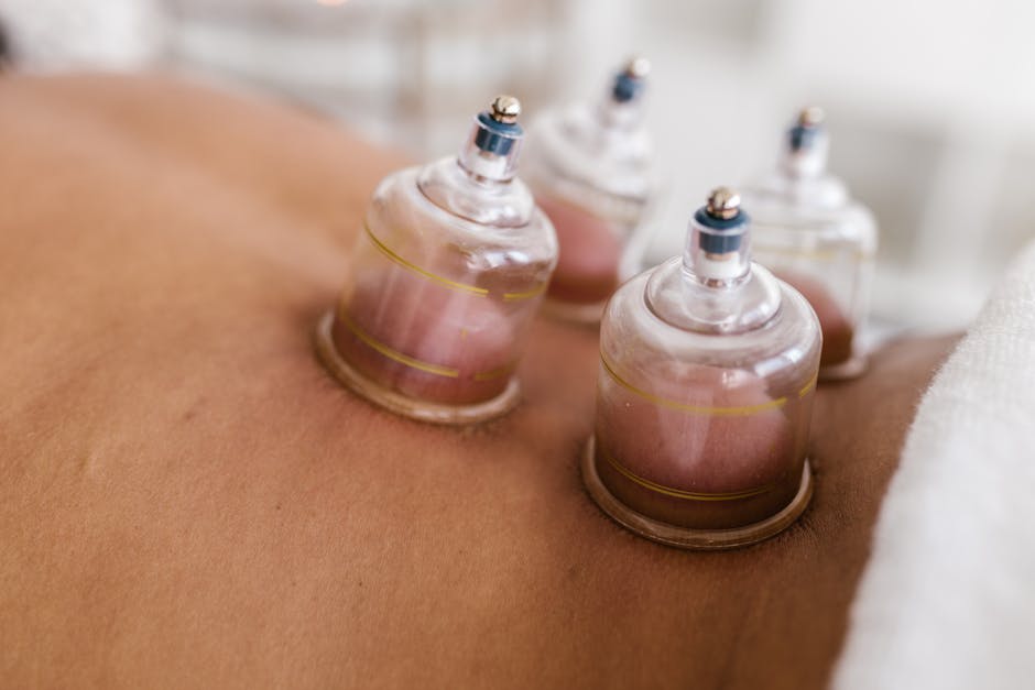 Benefícios da ventosaterapia para tensão muscular e estresse
