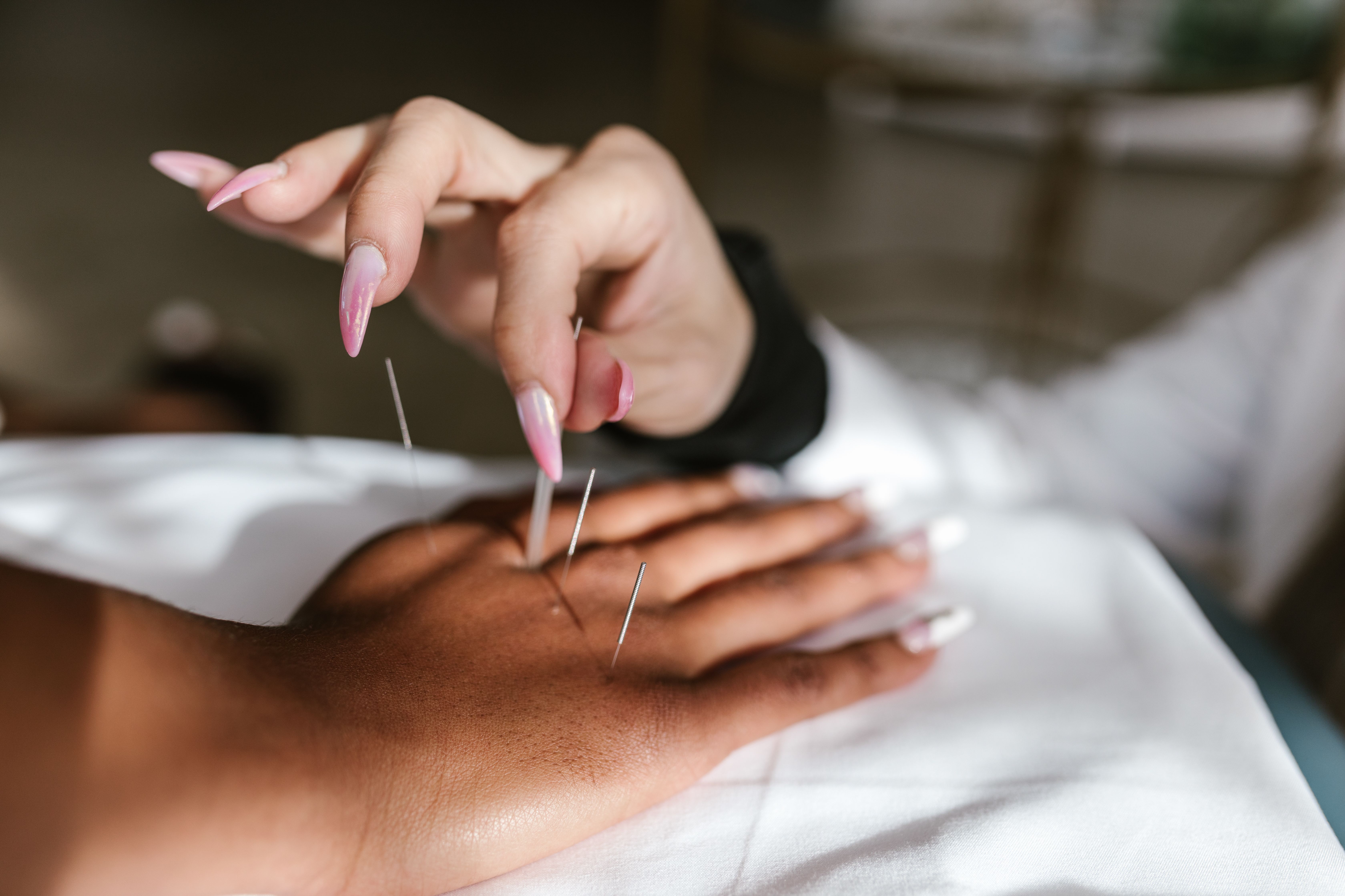Como a acupuntura ajuda no tratamento da depressão leve