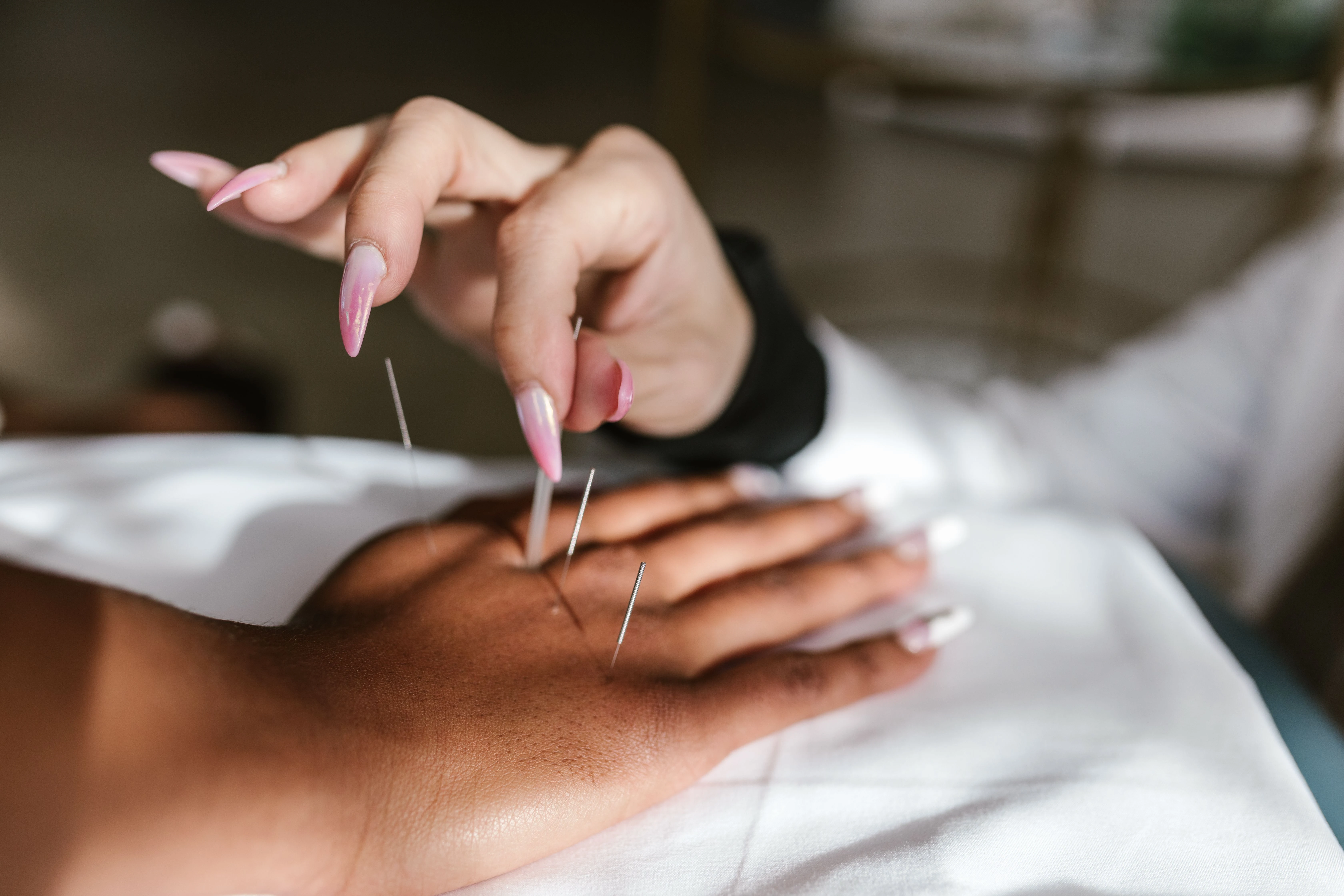Como a acupuntura ajuda no tratamento da depressão leve